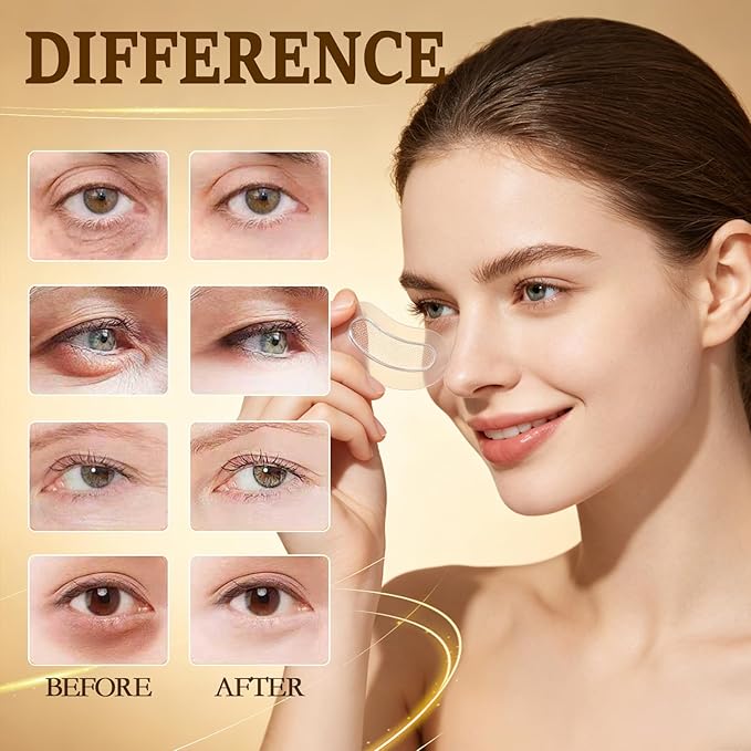 12 Count PDRN Micro Eye Patches,Dark Circle,Under Eye Patches For Puffy Eyes,Ceramides, Serum-Infused Eye Patches With Hyaluronic Acid & Collagen,Gentle Skin-Friendly