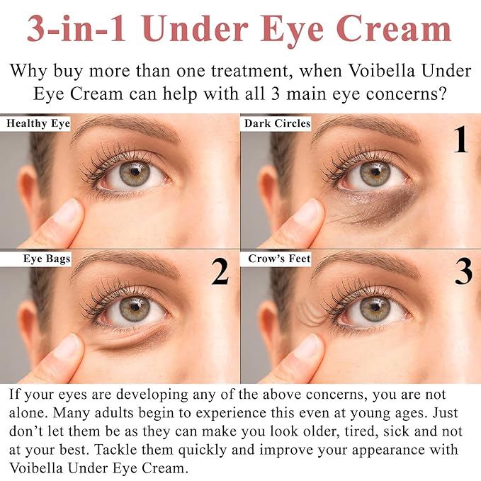 Under Eye Cream with Retinol, Peptides, Hyaluronic Acid & Aloe - Advanced Repair Formula for Puffiness, Bags, Dark Circles & Dry Under Eyes - Best Anti Wrinkle Eye Cream for Women & Men