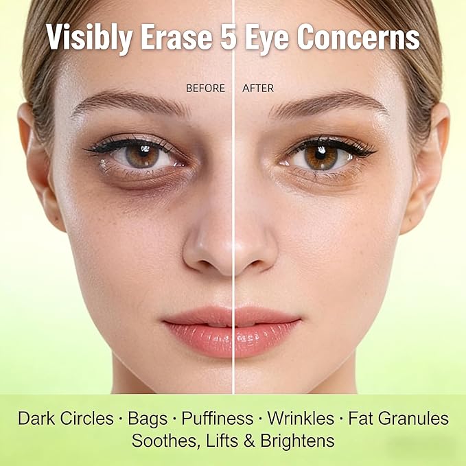 Under Eye Patches – 60 PCS Avocado Eye Patches for PUFFY EYES and DARK CIRCLES, Collagen Eye Patches,Hydrating & Moisturizing Eye Patches for Women,Reduce LINES and WRINKLES.