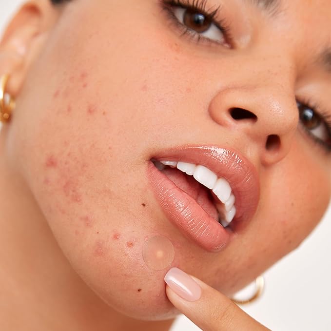 PEACE OUT Acne Healing Dots Helps Clear Blemishes Overnight, Fast Acting Hydrocolloid Pimple Patches for Breakouts with Salicylic Acid, Retinol and Aloe Vera, Award Winning Skincare Solution 40 Count
