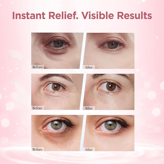 Retinol Eye Balm Stick - Under Eye Cream for Dark Circles & Puffiness with Caffeine, Collagen & Hyaluronic Acid, Eye Cream Anti Aging, Reduces Fine Lines, Wrinkles & Bags, Hydrating Retinol Eye Cream