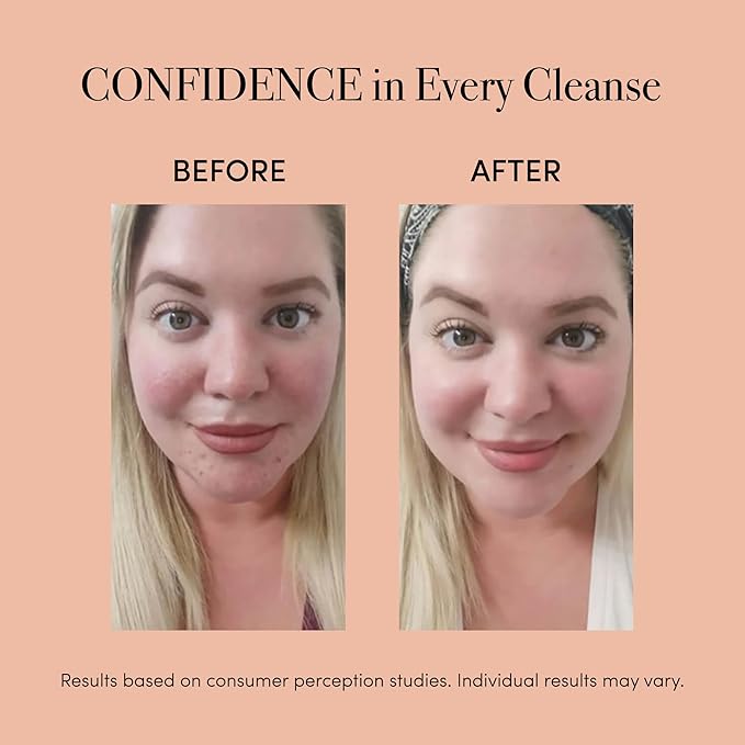 reVive Light Therapy Soniqué Mini Acne Cleanser, Battery-Operated Sonic Face Cleanser Brush with Blue & Red Light Therapy, Medical-Grade Acne Device for Face & Body, Water-Resistant, FSA HSA Eligible