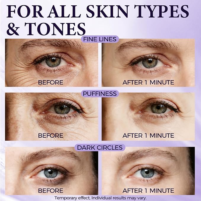 Tuggle Instant Eye & Face Tightening Serum, Instant Face Lift Cream Rapid Improve Under Eye Bags and Puffiness, Tightener Wrinkles & Fine Lines Fast, for Women & Men in Minutes, 0.67 oz