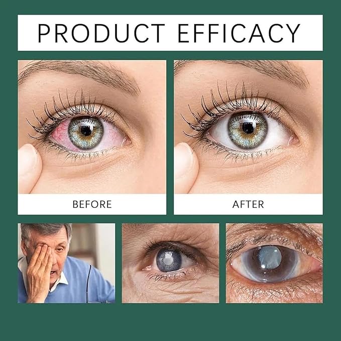 Optifusion Drops, Herbionyx Nano Drop Serum with Lutein, Vitamin C/E