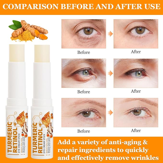2PCS Turmeric Retinol Eye Stick,Lumibalm for Under Eyes Bags,Eye Balm Stick Wrinkles,Hydrating for Dark Circle,For Puffiness and Bags Reduces Fine Lines