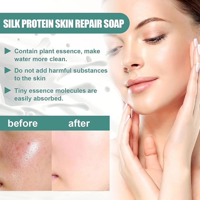 2PCs SkinFerm Collagen Milk Whitening Soap, Silk Protein Skin Repair Soap, Exfoliating and Brightening Soaps for Dull, Uneven Skin, Smooth And Soft Complexion for Face & Body