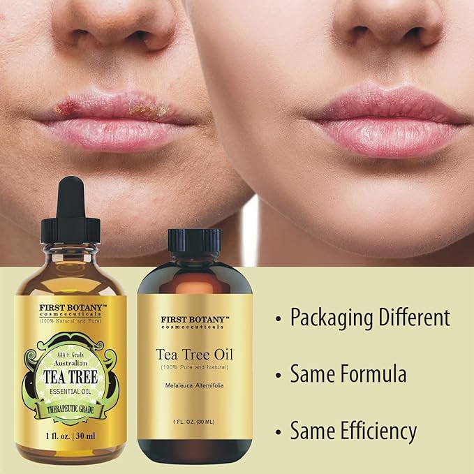 First Botany, 100% Pure Australian Tea Tree Essential Oil with high conc. of Terpinen - A Known Solution to Help in Fighting Acne, Toenail Issues, Dandruff. (1 fl oz) (Pack of 2)