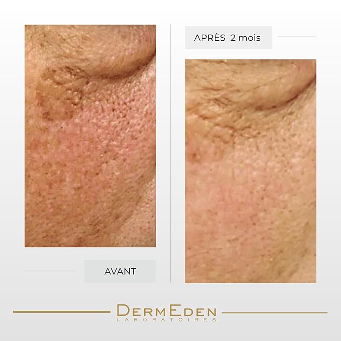 DERMEDEN NIGHT PROTOCOLE INTENSE ANTI-AGEING EYE CONTOUR CREAM 15ML …