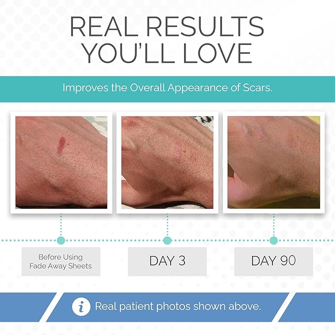 Clinically Proven Silicone Scar Sheets – Medical Grade Tape for Surgery, C-Section, Keloids & Tummy Tuck Scars