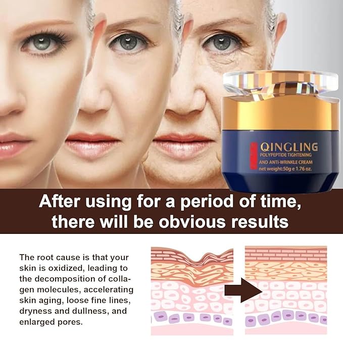 Qingling Face Cream, Qingling Wrinkle Removal Cream, Quinglin Polypeptide Tightening and Anti-Wrinkle Moisturizer, Face & Neck & Eye Lotion 3-In-1 (1)