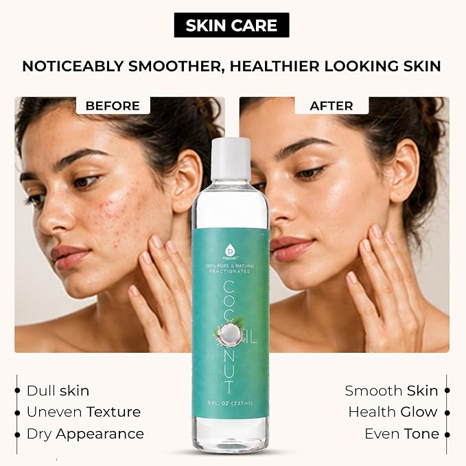 Pursonic Pure Unscented Fractionated Coconut Oil - 8 Oz Multipurpose Oil for Skin, Hair, Body Massage & Makeup Removal - Carrier Oil for Essential Oils and Aromatherapy