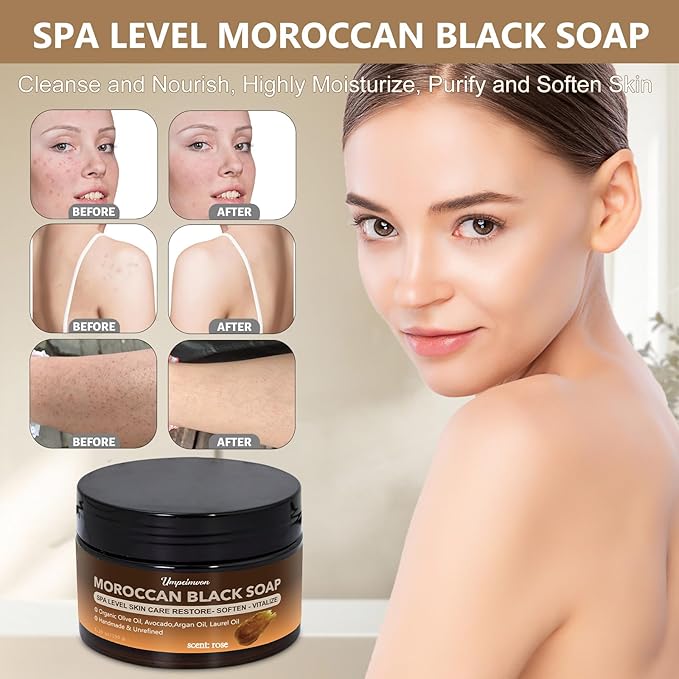 2 PCS Moroccan Black Soap with Argan and Rose Oil, SPA Level Handmade Black Beldi Soap Exfoliating and Softening, Natural and Organic for Face, Body, Hair and Shave, Rose Scent, 5.29 oz/150 g
