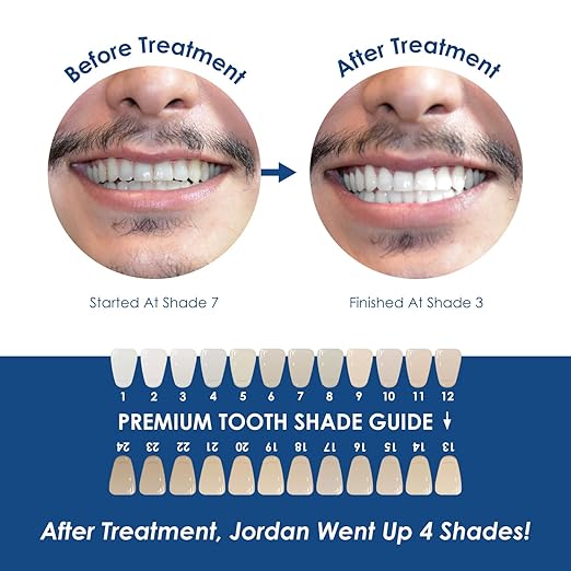 Whiter Image Deluxe Teeth Whitening Syringe Refill to Eliminate Teeth Discoloration While Fighting Plaque Bacteria, Teeth Whitening Set for A Stronger Enamel