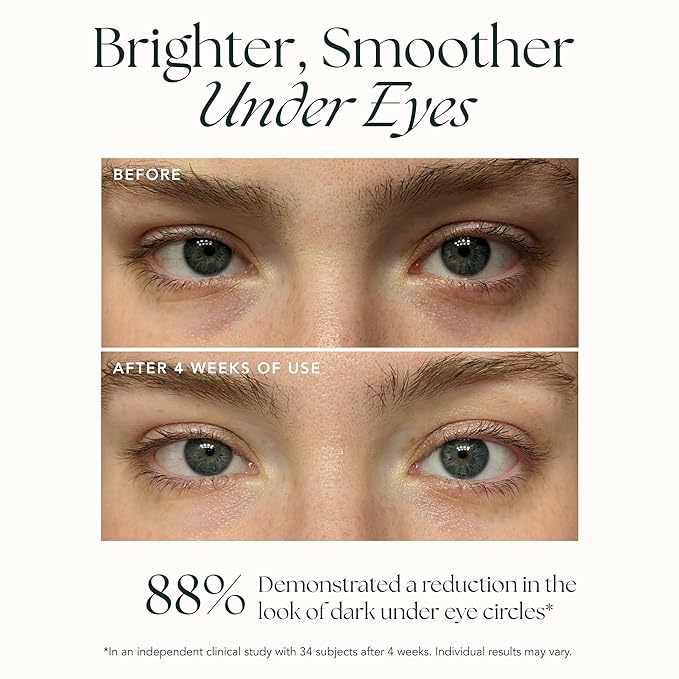 RANAVAT Brightening Retinol Eye Cream - Anti Aging Eye Cream and Dark Circle Corrector to Help Target Fine Lines - Enriched with Micro-Encapsulated Retinol, Bakuchi Seed, & Saffron (0.5 oz)