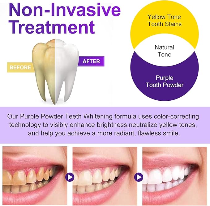 Teeth Whitening Powder - Teeth Whitening - Removes Stains - No Sensitivity - Toothpaste Power - Breath Freshener - for C1offee, Tea and Tobacco Stains 15g