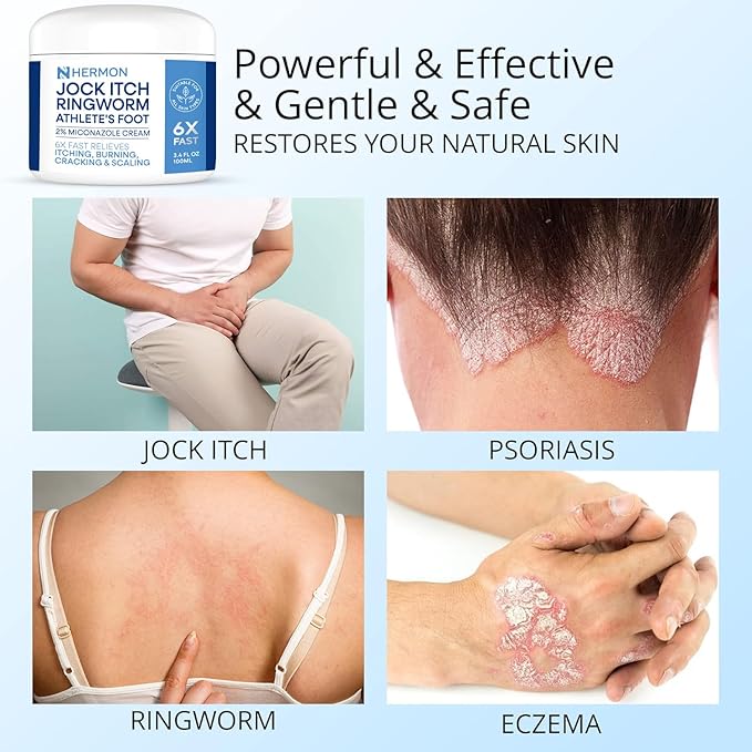 Jock Itch Antifungal Cream, Ringworm Treatment for Humans, Psoriasis Treatment, Psoriasis Scalp Treatment, Ringworm Cream for Humans, Foot & Body Balm, Provides Soothing Relief-100g