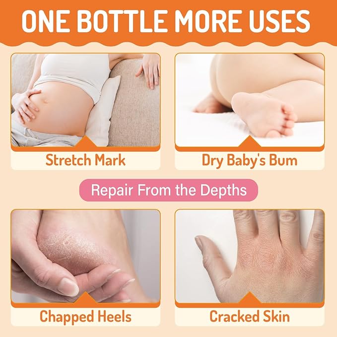 Stretch Mark Belly Butter-Packed with Vitamin E, Coconut Oil, and Sunflower Seed Oil to Protect, Soothe, and Rejuvenate Skin - Safe for Pregnancy and Nursing-Repair Stretch Marks and Scars.7.055oz