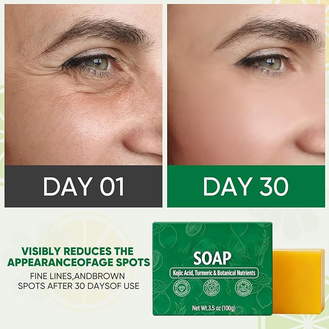 Turmeric Lemon Soap Bar, Turmeric Lemon Cleansing Soap for Dark Spots, Support Nourishes and Clarifies Facial Body Skin, Suitable for All Skin Types (2pcs)
