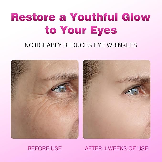 Retinol Eye Cream Balm, Hydrating Under Eye Care Daily Wrinkle Cream, Infused with Caffeine to Smooth and Hydrate Skin, Eye Serum for Anti Aging Reduce Wrinkles, Puffiness and Bags Under Eyes, 0.28 oz