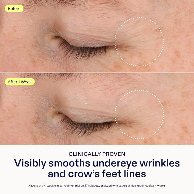 Skinfix Triple Lipid-Boost 360 Eye - 0.5 fl oz - Visibly Smooths Undereye Wrinkles & Crow’s Feet Lines with Hyaluronic Acid - Non-Comedogenic - Vegan, Cruelty Free - Founded in Canada