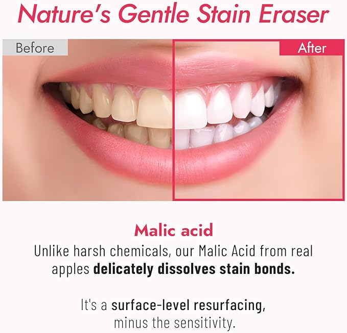Vebanler MALIC Acid Teeth Whitening Toothpaste,Natural Care Deep Stain Removal&Plaque,Fluoride Free,Non Toxic,for Adults, Kids and Sensitive Teeth，with Niacinamide，3.57oz.