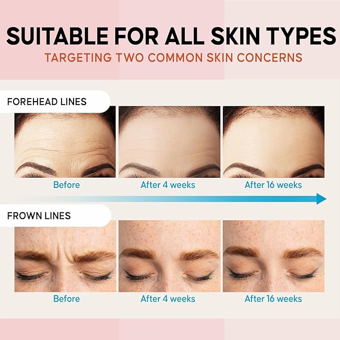 Forehead Wrinkle Patches Overnight 12 Pcs with Collagen: Forehead Fine Lines and Deep Wrinkles Treatment Remover, Anti Forehead and Between the Eyes Facial Wrinkle Patches, Hypoallergenic Patches