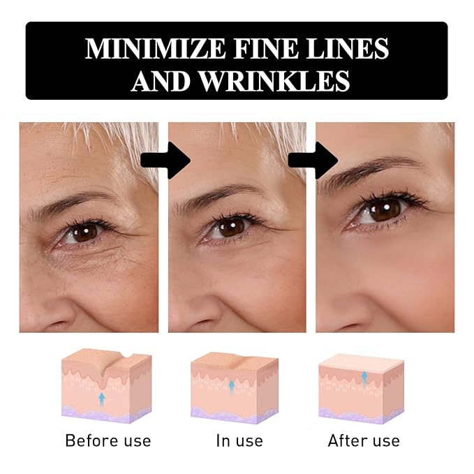 Snake Peptide Eye Cream，Anti-Aging Eye Cream for Dark Circles, Puffiness & Wrinkles, Hydrating Eye Treatment with Niacinamide & Glycerin (1)