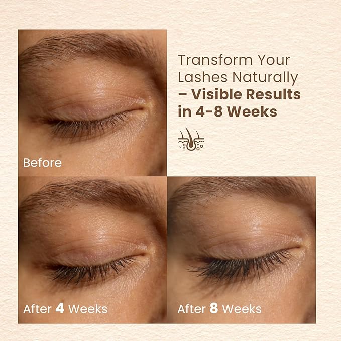 Lash Serum for Eyelash Growth, Eyelash Serum for Longer, Fuller & Stronger Lashes, With Natural Formula for Sensitive Eyes, Prostaglandin-Free, Vegan & Cruelty-Free （6ml）