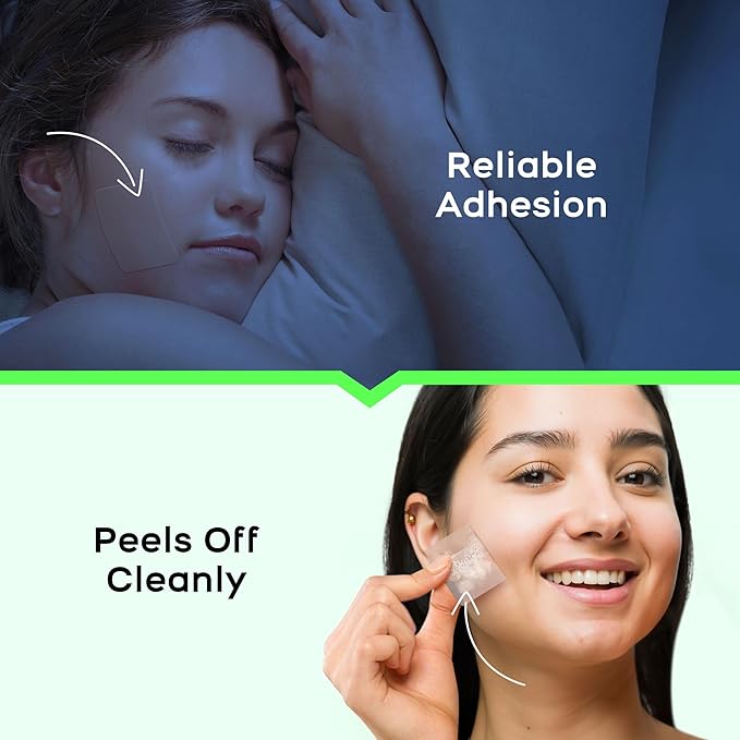 XL Hydrocolloid Acne Patches - Extra Large Pimple Patches for Cystic Acne on Face & Body | Nose, Chin, Back & Bacne Treatment | Vegan & Cruelty-Free (10 Count)
