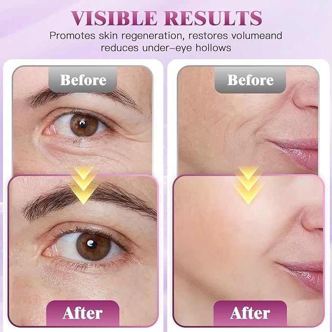 Auriela Calcium Volume Multi Balm,Calcium Multi Balm Stick,Anti Wrinkle,Anti-Aging,Long-Lasting Hydrating, Firming Skin, for Face, Eyes, Lips & Neck (Pack of 4)