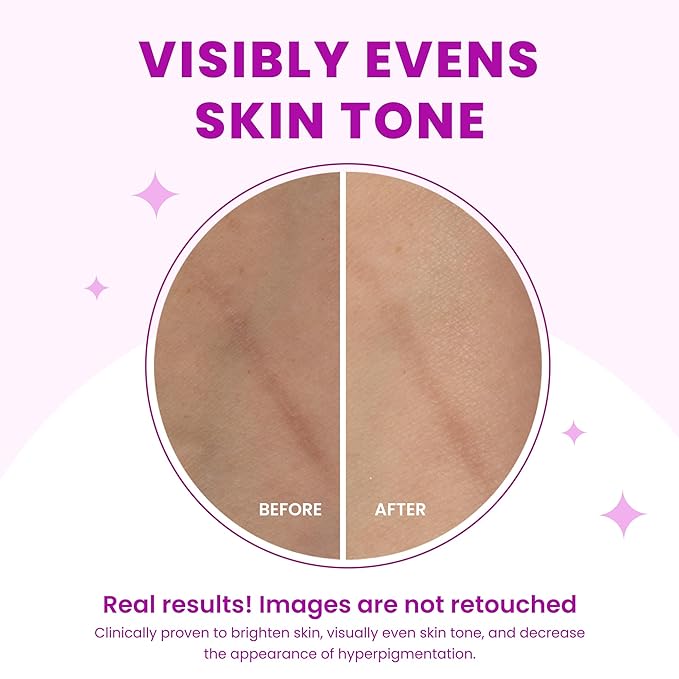 Lume Acidified Body Wash - 24 Hour Odor Control - Removes Odor Better than Soap - Moisturizing Formula - Formulated Without SLS or Parabens - OB/GYN Developed - 8.5 ounce (Peony Rose)