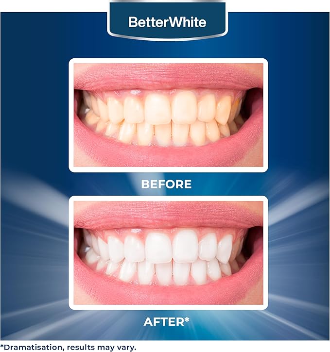 BetterWhite Teeth Whitening Powder - Hydroxyapatite, Remineralizing, Non-Sensitive Formula - Dentist-Approved Tooth Stain Remover & Polisher - Fluoride-Free (30 Grams)