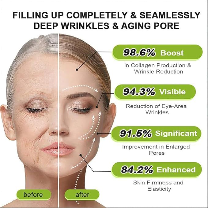 Celestvera Botoxmix Cream,Anti-Wrinkle Cream,Wrinkle Anti New Pore Minimizer Cream, Lift Tightening Retinol Booster, Retinal Serum, Advanced Body Lotion Bottle 1PCS