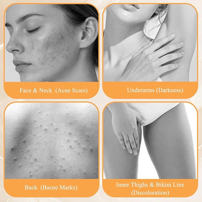 Turmeric Kojic Acid Soap for Dark Spots with Turmeric, Vitamin C & Shea Butter, Brightening Face & Body Wash, Even Tone Skin Cleanser for Hyperpigmentation & Inner Thighs, 2 Pack