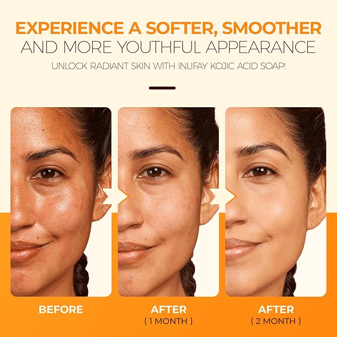 Inlifay Turmeric Soap for Dark Spots: Kojic Acid Soap for Women with Hyperpigmentation - Home Travel Use Skin Cleansing Size: 1.17 Ounce (Pack of 6)
