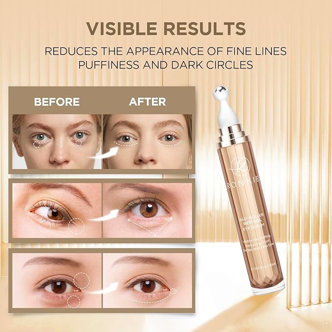 RONKIE Eye Cream for Dark Circles: Under Eye Cream with Caffeine Retinol - Reduces Under Eye Bags and Fine Lines Pink