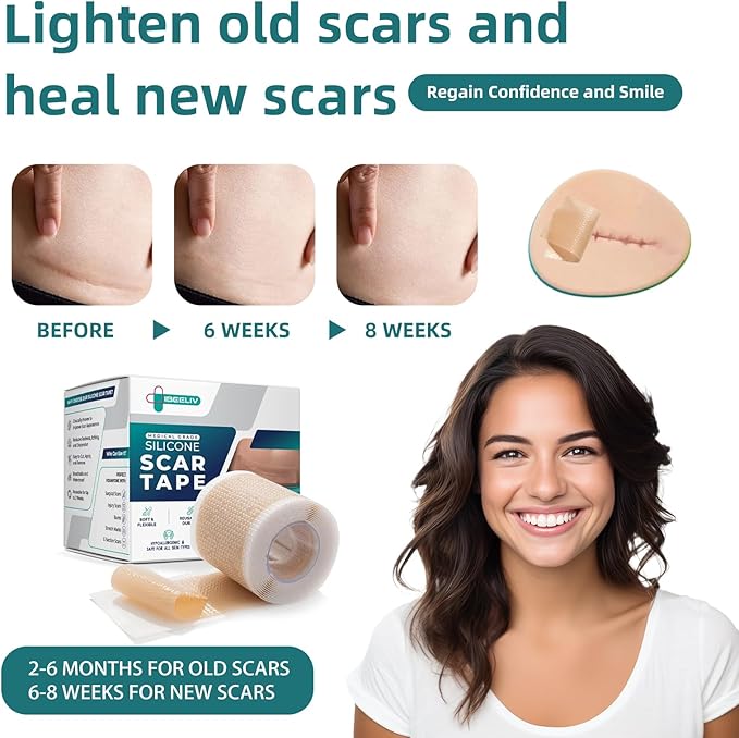 Silicone Scar Tape for Surgical Scars: Medical Grade Scar Gel Sheets for C-Section Tummy Tuck Recovery and Treatment – Reusable Scar Strips for Keloid Burn Acne Scars Removal (1.6'' x 60''Roll-1.5M)
