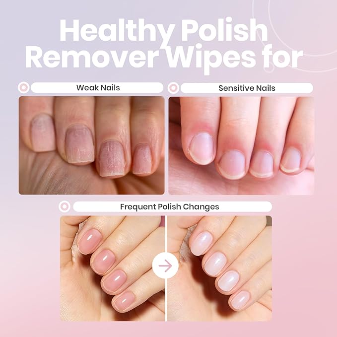 Beetles Acetone-Free Nail Polish Remover Pads - 50 Count Nail Scrubbers 2-in-1 Prep & Lacquer Remover Nail Polish Remover Wipes Travel-Friendly Fingernail Polish Remover with vitamin E