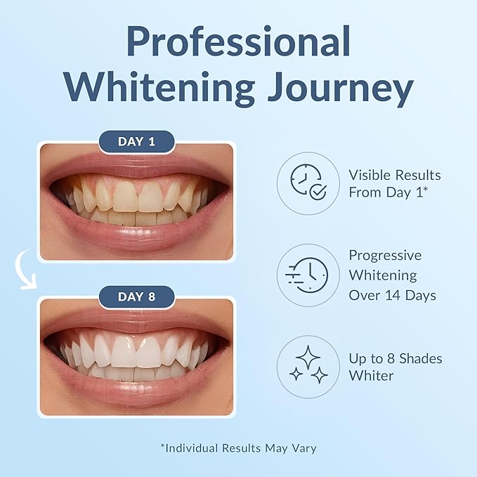 Professional Teeth Whitening Strips - Pack of 44 Strip - 22 Treatments Kit - Safe for Enamel - Non Sensitive Teeth Whitening - Whitening Without Any Harm + Mouth Opener Included