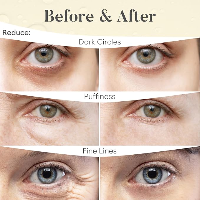 BLOOMORA 24K Gold Under Eye Patches (30 Pairs) - For Dark Circles & Puffiness - Hydrating Eye Mask for a Revitalized Look