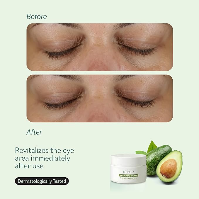 sinoz Eye Cream Avocado,Lipsomal caffeine, Bright and tight, Masks for Dark Circles & Puffy Eyes, Under eye cream. 0.5 fl oz & 15 ml