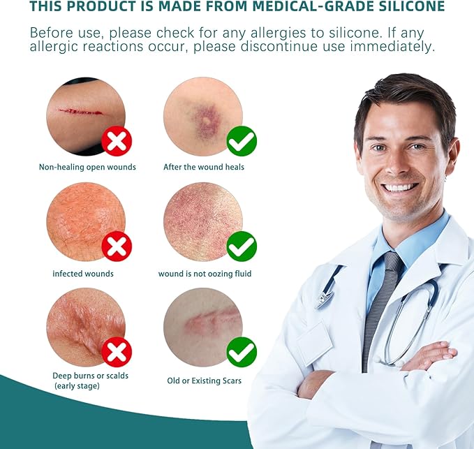 Silicone Scar Tape for Surgical Scars: Medical Grade Scar Gel Sheets for C-Section Tummy Tuck Recovery and Treatment – Reusable Scar Strips for Keloid Burn Acne Scars Removal (1.6'' x 60''Roll-1.5M)