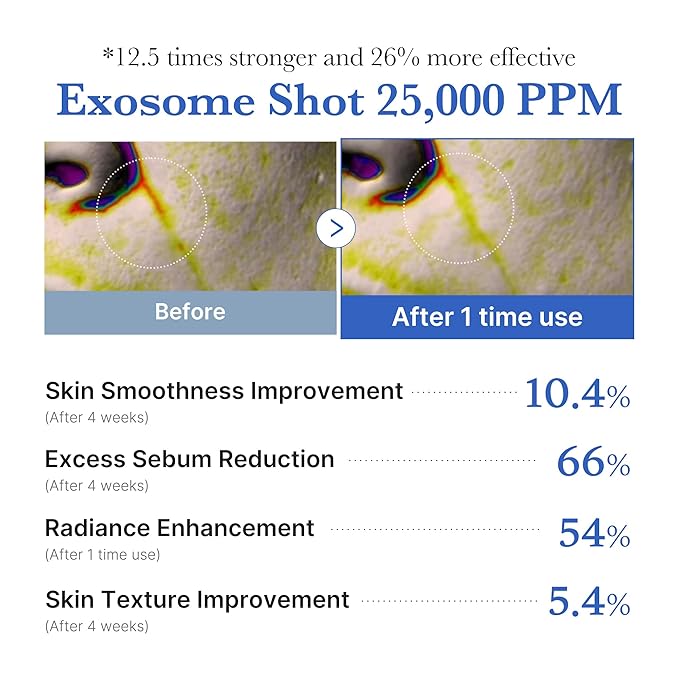medicube Zero Exosome Shot 25,000 PPM Spicule Facial Serum | Liquid Skin Booster Serum | Exosome, AHA+BHA+PHA | Pore Care, Dead Skin Cells, Skin Texture | Korean Skin Care 0.43 fl.oz