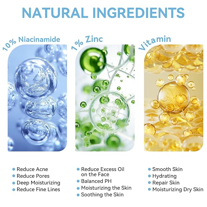 Niacinamide 10% + Zinc 1% Serum for Face – Oil Control, Acne, Pore Minimizer & Blemish Reduction – Lightweight, Non-Greasy Facial Serum, 30ml (1 Fl Oz) (1)