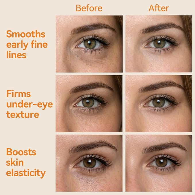 Pulse Energy Retinol Under Eye Patches (28 Pairs), Bakuchiol, Peptides & Vitamin A Hydrogel Eye Mask for All Skin Types, including Sensitive Skin - Smooth Fine Lines & Wrinkles, Firming Lift