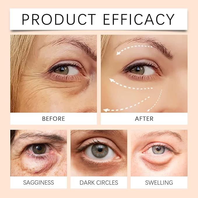 5D Peptide Anti-Wrinkle Eye Cream, Anti-Wrinkle Firming Eye Cream, 5D Peptide Anti Aging Eye Cream, Peptide Lifting Eye Gel, For Dark Circles and Puffiness (2pcs)