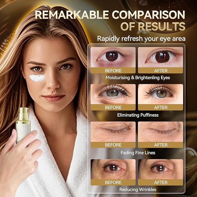 BREYLEE Renewal Eye Serum for Puffy Eye Bags Fine Lines Dark Circles Wrinkles, Anti-Puffiness & Fading Fine Lines, with Coffine Niacinamide Polypeptide