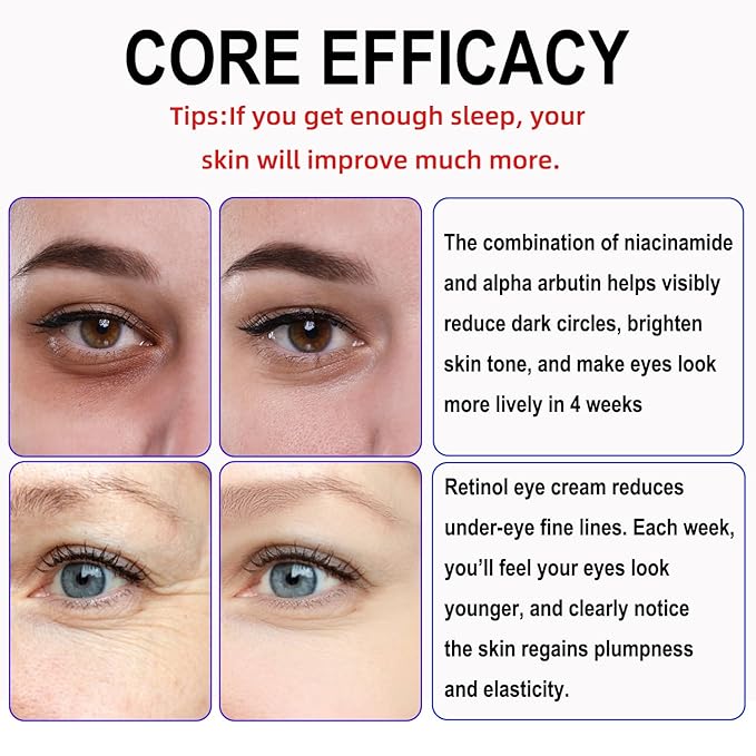 Retinol Eye Cream with Niacinamide, Hyaluronic Acid & Vitamin E – Hydrating Under Eye Cream for Visible Dark Circles, Wrinkle Appearance & Under-Eye Fullness, Anti Aging