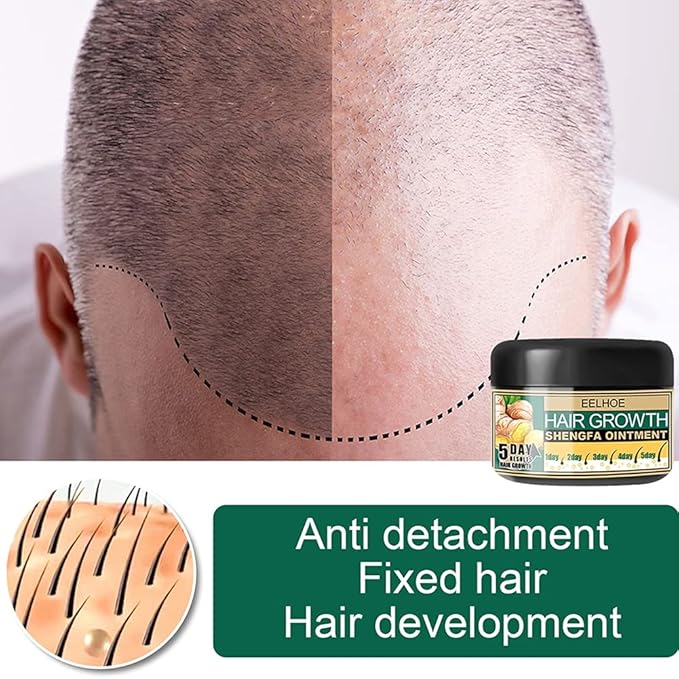 Ginger Hair Growth Cream, Germinal Conditioner, Regrowth Serum - Unisex, For Hair Loss and Thinning(30g/1 OZ sample)