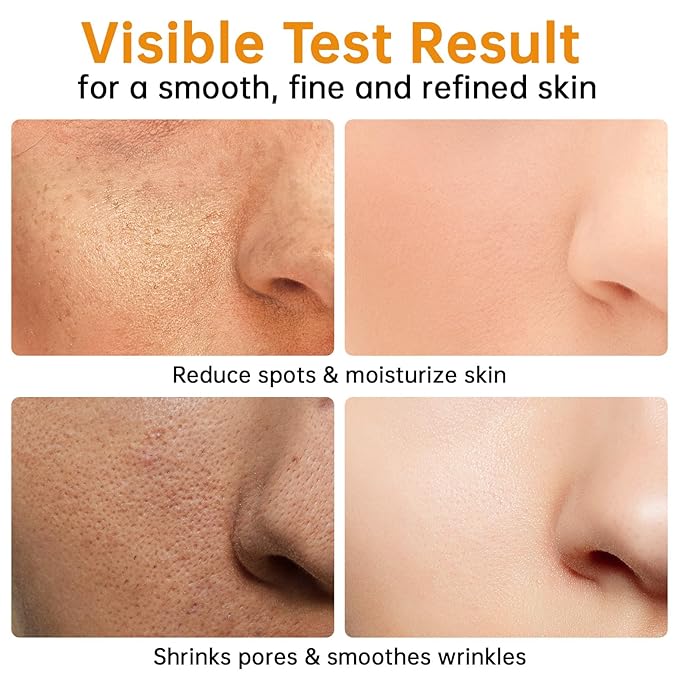 Turmeric Serum for Face, 30 ML/ 1 PCS Anti Aging Turmeric Facial Serum, Turmeric Oil, Moisturizes & Firms Skin, Reduces Wrinkles & Fine Lines, Skin Care Essence for Dryness, Hydrates Face